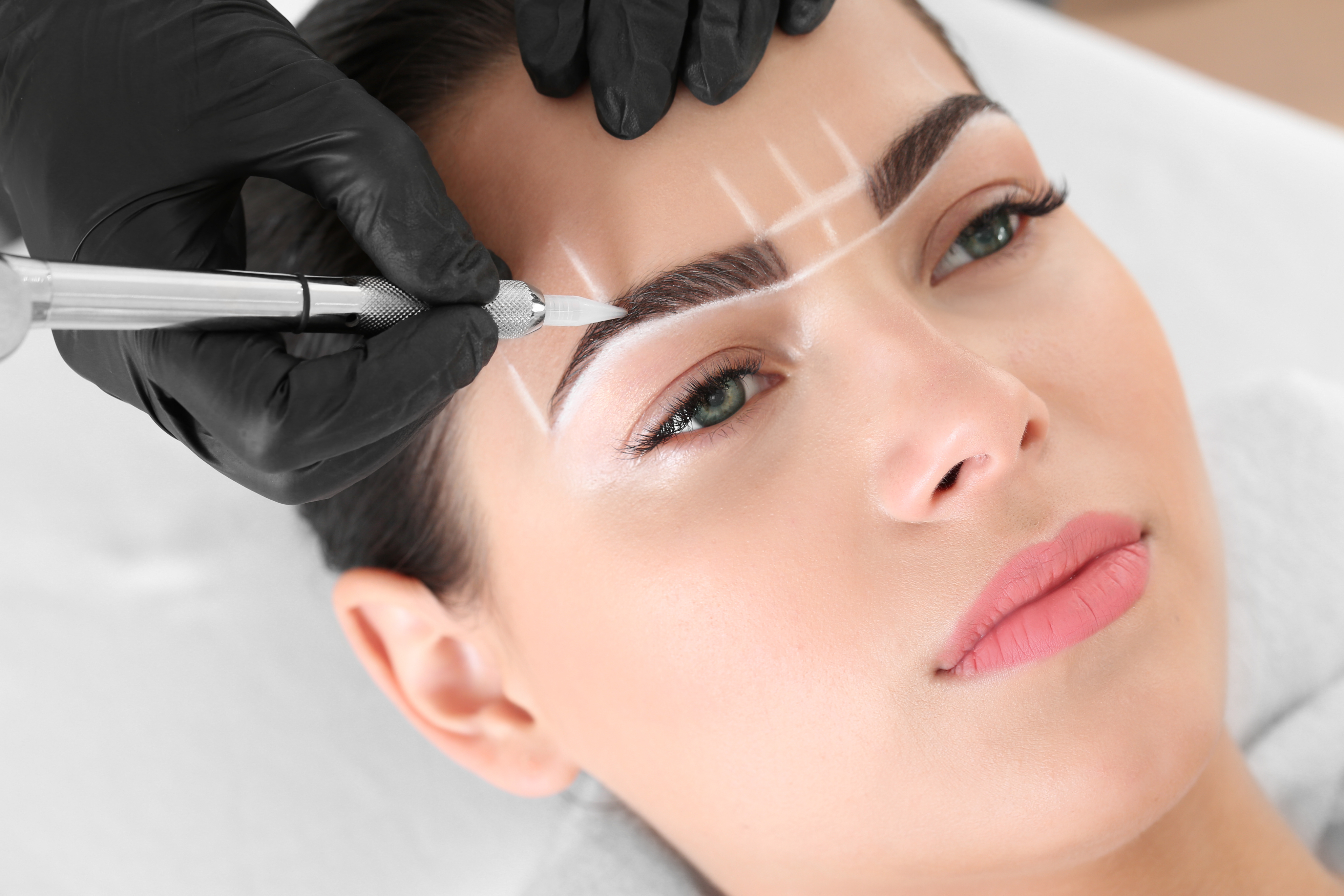Eyebrow Transplantation