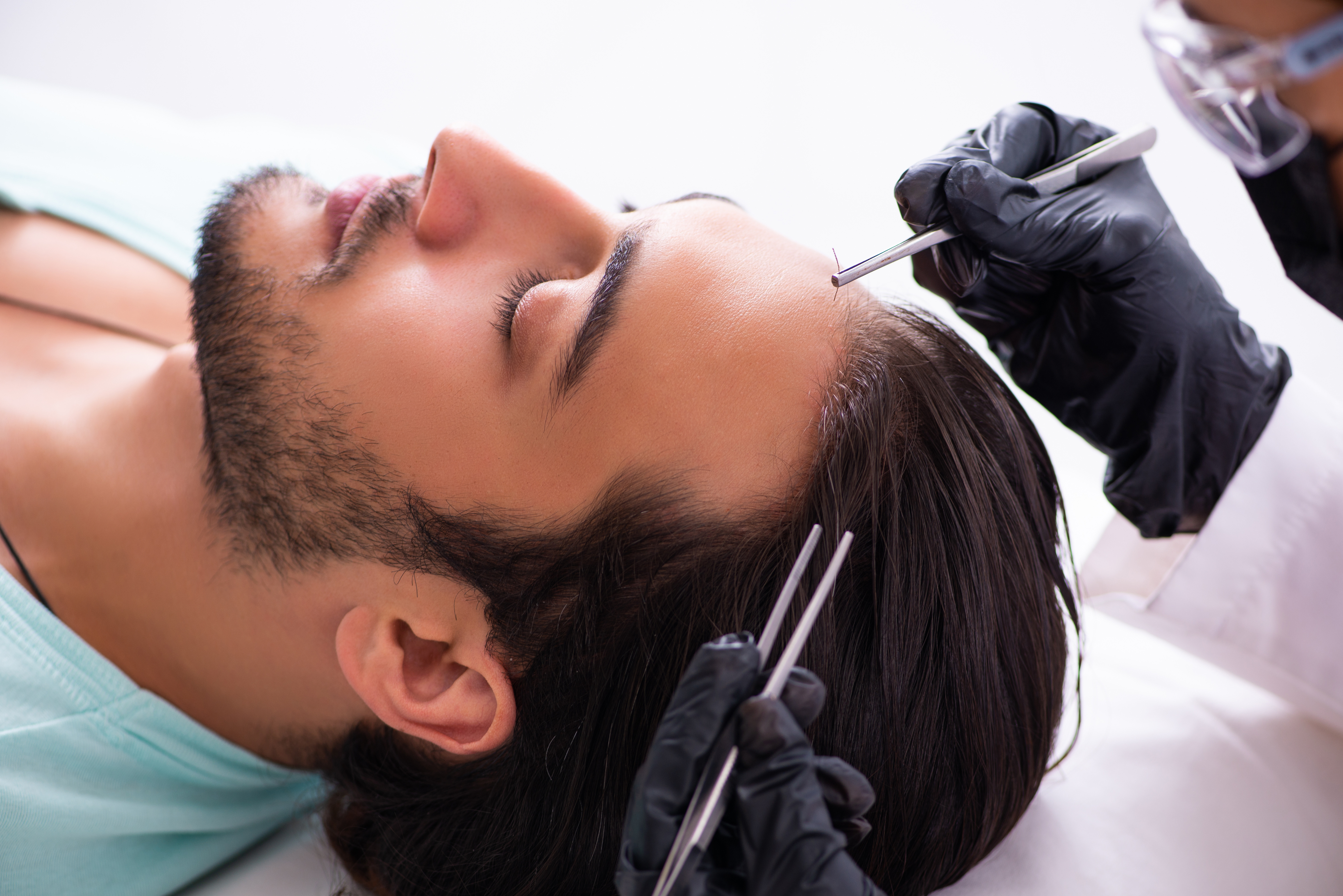 hair-transplant hero item 3