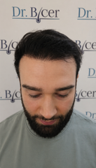 Patient after 8